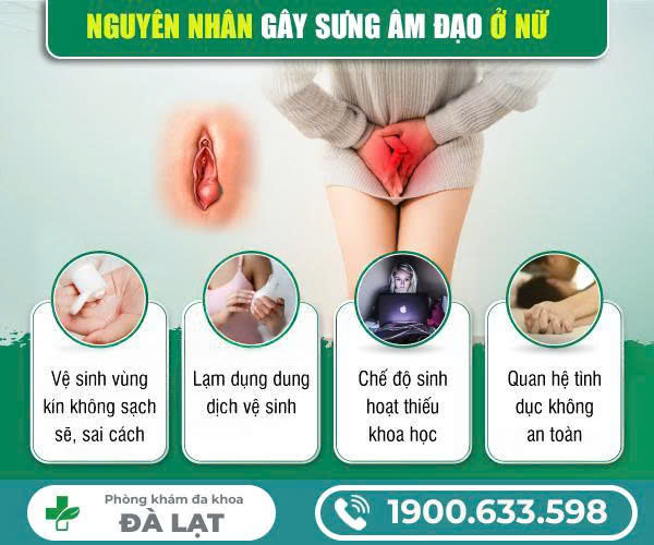 Hình ảnh minh họa